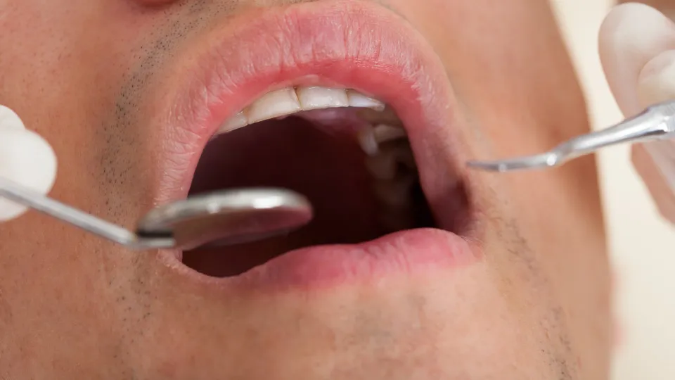 32% dos brasileiros não foram ao dentista no último ano